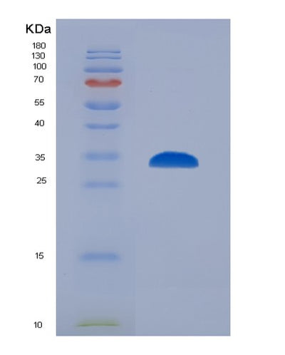 SDS-PAGE analysis of Human IMPDH2 (Inosine-5'-Monophosphate Dehydrogenase 2) - Recombinant Protein, CAT# BLT-01563P, showing >95% purity under 15% SDS-PAGE (Reduced)Human IMPDH2 (Inosine-5'-Monophosphate Dehydrogenase 2) - Recombinant Protein