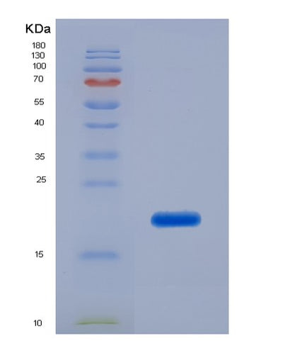 SDS-PAGE analysis of Human PIP (Prolactin-Inducible Protein) - Recombinant Protein, CAT# BLT-02272P, showing >95% purity under 15% SDS-PAGE (Reduced)Human PIP (Prolactin-Inducible Protein) - Recombinant Protein