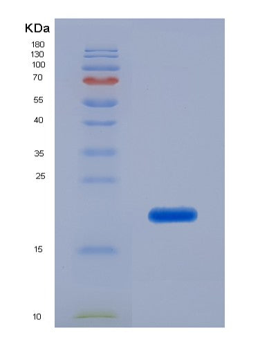 SDS-PAGE analysis of Human PIP (Prolactin-Inducible Protein) - Recombinant Protein, CATHuman PIP (Prolactin-Inducible Protein) - Recombinant Protein