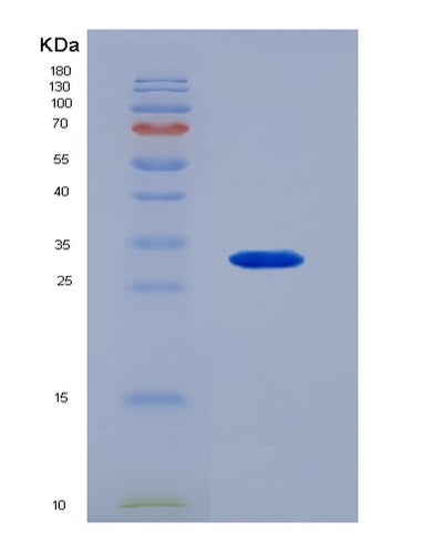 SDS-PAGE analysis of Human FCGR2A (Low Affinity Immunoglobulin Gamma Fc Region Receptor Ii-A) - Recombinant Protein, CAT# BLT-01063P, showing >95% purity under 15% SDS-PAGE (Reduced)Human FCGR2A (Low Affinity Immunoglobulin Gamma Fc Region Receptor Ii-A) - Recombinant Protein