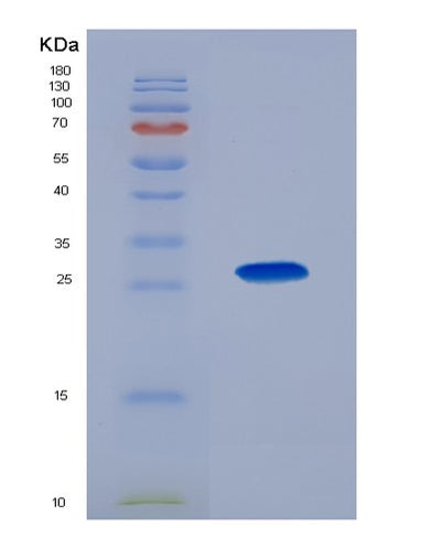 SDS-PAGE analysis of Human CKMT1A (Creatine Kinase U-Type, Mitochondrial) - Recombinant Protein, CAT# BLT-00613P, showing >85% purity under 15% SDS-PAGE (Reduced)Human CKMT1A (Creatine Kinase U-Type, Mitochondrial) - Recombinant Protein