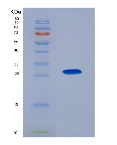 SDS-PAGE analysis of Human CKMT1A (Creatine Kinase U-Type, Mitochondrial) - Recombinant Protein, CATHuman CKMT1A (Creatine Kinase U-Type, Mitochondrial) - Recombinant Protein