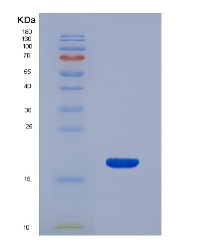 SDS-PAGE analysis of Human RNASE3 (Eosinophil Cationic Protein) - Recombinant Protein, CAT# BLT-02591P, showing >90% purity under 15% SDS-PAGE (Reduced)Human RNASE3 (Eosinophil Cationic Protein) - Recombinant Protein