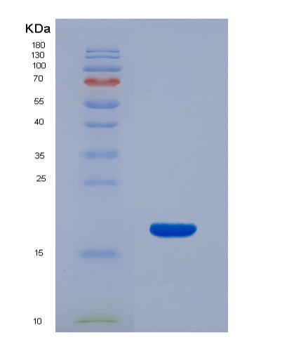 SDS-PAGE analysis of Human RNASE3 (Eosinophil Cationic Protein) - Recombinant Protein, CATHuman RNASE3 (Eosinophil Cationic Protein) - Recombinant Protein