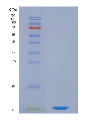 SDS-PAGE analysis of Human CCL5 (C-C Motif Chemokine 5) - Recombinant Protein, CAT# BLT-02519P, showing >90% purity under 15% SDS-PAGE (Reduced)Human CCL5 (C-C Motif Chemokine 5) - Recombinant Protein