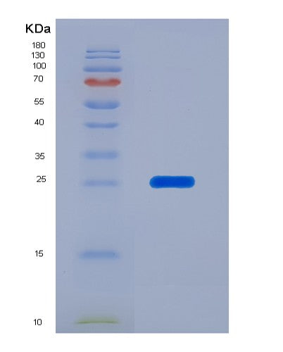 SDS-PAGE analysis of Human EEF2 (Elongation Factor 2) - Recombinant Protein, CATHuman EEF2 (Elongation Factor 2) - Recombinant Protein