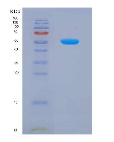 SDS-PAGE analysis of Human ACP5 (Tartrate-Resistant Acid Phosphatase Type 5) - Recombinant Protein, CAT# BLT-07551P, showing >90% purity under 15% SDS-PAGE (Reduced)Human ACP5 (Tartrate-Resistant Acid Phosphatase Type 5) - Recombinant Protein