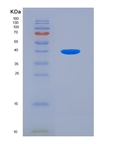 SDS-PAGE analysis of Human ALAD (Delta-Aminolevulinic Acid Dehydratase) - Recombinant Protein, CAT# BLT-00113P, showing >85% purity under 15% SDS-PAGE (Reduced)Human ALAD (Delta-Aminolevulinic Acid Dehydratase) - Recombinant Protein