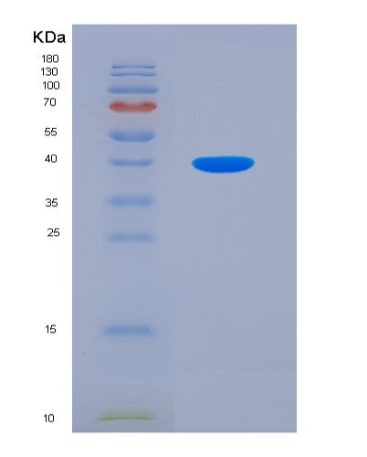SDS-PAGE analysis of Human ALAD (Delta-Aminolevulinic Acid Dehydratase) - Recombinant Protein, CATHuman ALAD (Delta-Aminolevulinic Acid Dehydratase) - Recombinant Protein
