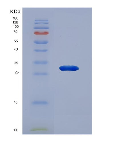 SDS-PAGE analysis of Human HSD17B1 (17-Beta-Hydroxysteroid Dehydrogenase Type 1) - Recombinant Protein, CAT# BLT-01426P, showing >95% purity under 15% SDS-PAGE (Reduced)Human HSD17B1 (17-Beta-Hydroxysteroid Dehydrogenase Type 1) - Recombinant Protein