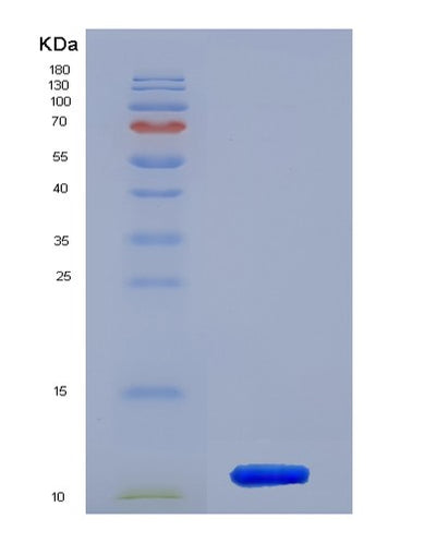 SDS-PAGE analysis of Mouse S100a6 (Protein S100-A6) - Recombinant Protein, CAT# BLT-02675P, showing >95% purity under 15% SDS-PAGE (Reduced)Mouse S100a6 (Protein S100-A6) - Recombinant Protein