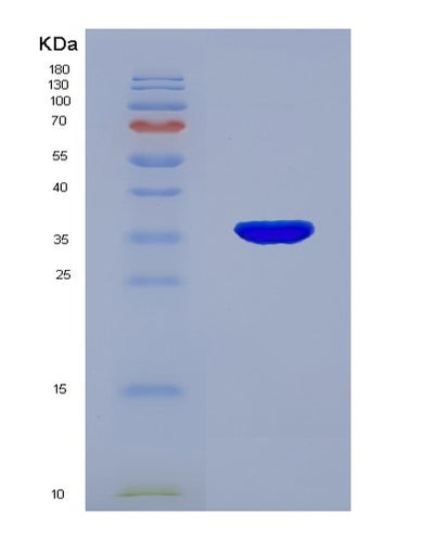 SDS-PAGE analysis of Human EP300 (Histone Acetyltransferase P300) - Recombinant Protein, CAT# BLT-07552P, showing >90% purity under 15% SDS-PAGE (Reduced)Human EP300 (Histone Acetyltransferase P300) - Recombinant Protein