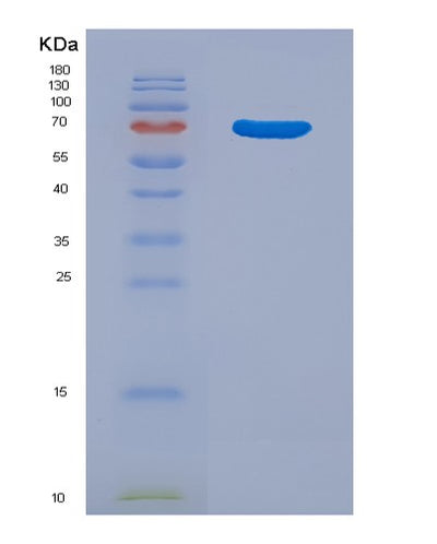 SDS-PAGE analysis of Human CTSE (Cathepsin E) - Recombinant Protein, CAT# BLT-00755P, showing >90% purity under 15% SDS-PAGE (Reduced)Human CTSE (Cathepsin E) - Recombinant Protein