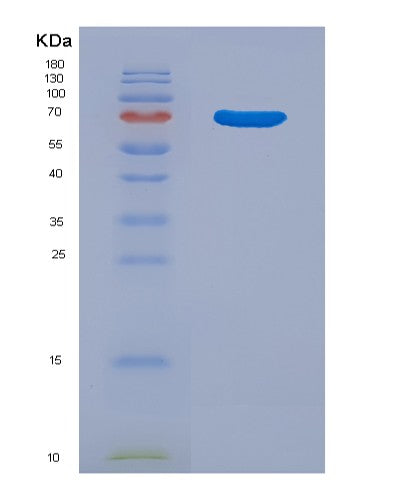 SDS-PAGE analysis of Human CTSE (Cathepsin E) - Recombinant Protein, CATHuman CTSE (Cathepsin E) - Recombinant Protein