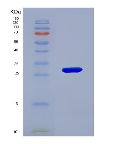 SDS-PAGE analysis of Human KLF5 (Krueppel-Like Factor 5) - Recombinant Protein, CAT# BLT-07553P, showing >90% purity under 15% SDS-PAGE (Reduced)Human KLF5 (Krueppel-Like Factor 5) - Recombinant Protein