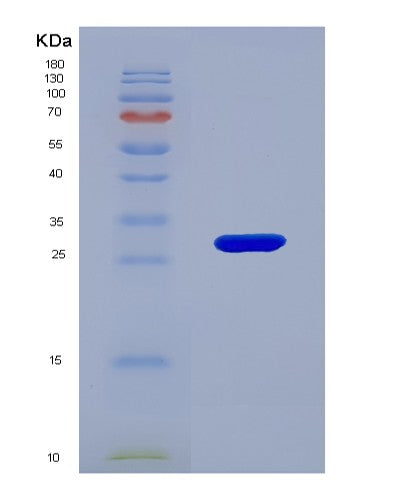 SDS-PAGE analysis of Human KLF5 (Krueppel-Like Factor 5) - Recombinant Protein, CATHuman KLF5 (Krueppel-Like Factor 5) - Recombinant Protein