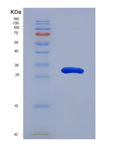 SDS-PAGE analysis of Mouse Lrp1 (Prolow-Density Lipoprotein Receptor-Related Protein 1) - Recombinant Protein, CAT# BLT-07554P, showing >90% purity under 15% SDS-PAGE (Reduced)Mouse Lrp1 (Prolow-Density Lipoprotein Receptor-Related Protein 1) - Recombinant Protein