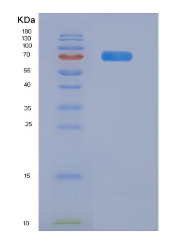 SDS-PAGE analysis of Human FDPS (Farnesyl Pyrophosphate Synthase) - Recombinant Protein, CAT# BLT-05788P, showing >90% purity under 15% SDS-PAGE (Reduced)Human FDPS (Farnesyl Pyrophosphate Synthase) - Recombinant Protein