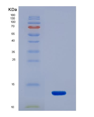 SDS-PAGE analysis of Human PKM (Pyruvate Kinase Pkm) - Recombinant Protein, CAT# BLT-02278P, showing >90% purity under 15% SDS-PAGE (Reduced)Human PKM (Pyruvate Kinase Pkm) - Recombinant Protein