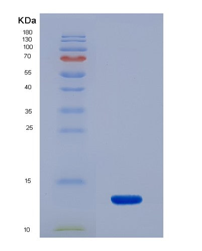 SDS-PAGE analysis of Human PKM (Pyruvate Kinase Pkm) - Recombinant Protein, CATHuman PKM (Pyruvate Kinase Pkm) - Recombinant Protein
