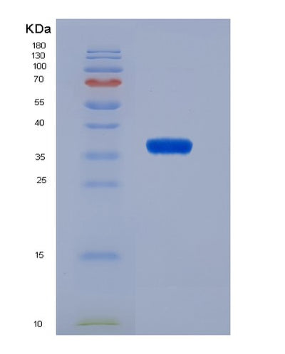 SDS-PAGE analysis of Human VCAN (Versican Core Protein) - Recombinant Protein, CAT# BLT-07555P, showing >90% purity under 15% SDS-PAGE (Reduced)Human VCAN (Versican Core Protein) - Recombinant Protein