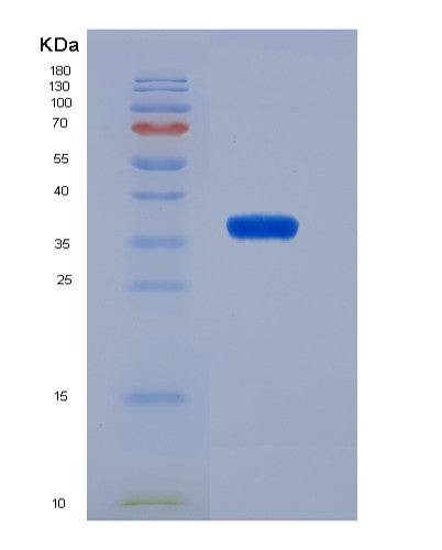 SDS-PAGE analysis of Human VCAN (Versican Core Protein) - Recombinant Protein, CATHuman VCAN (Versican Core Protein) - Recombinant Protein