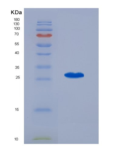 SDS-PAGE analysis of Human PTGES2 (Prostaglandin E Synthase 2) - Recombinant Protein, CATHuman PTGES2 (Prostaglandin E Synthase 2) - Recombinant Protein