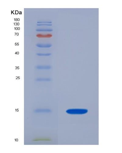 SDS-PAGE analysis of Human ACYP2 (Acylphosphatase-2) - Recombinant Protein, CAT# BLT-03972P, showing >85% purity under 15% SDS-PAGE (Reduced)Human ACYP2 (Acylphosphatase-2) - Recombinant Protein