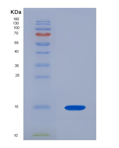 SDS-PAGE analysis of Human ACYP2 (Acylphosphatase-2) - Recombinant Protein, CATHuman ACYP2 (Acylphosphatase-2) - Recombinant Protein