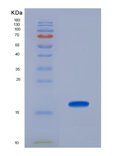 SDS-PAGE analysis of Human DARS1 (Aspartate--Trna Ligase, Cytoplasmic) - Recombinant Protein, CAT# BLT-00807P, showing >95% purity under 15% SDS-PAGE (Reduced)Human DARS1 (Aspartate--Trna Ligase, Cytoplasmic) - Recombinant Protein