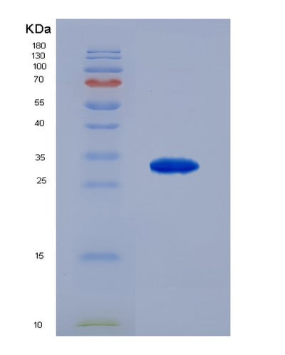 SDS-PAGE analysis of Human ARSA (Arylsulfatase A) - Recombinant Protein, CAT# BLT-00228P, showing >85% purity under 15% SDS-PAGE (Reduced)Human ARSA (Arylsulfatase A) - Recombinant Protein