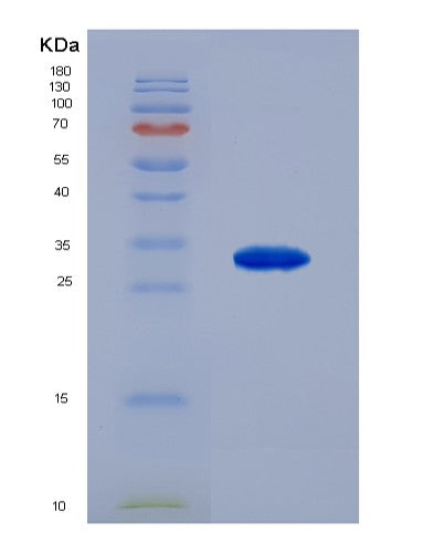 SDS-PAGE analysis of Human ARSA (Arylsulfatase A) - Recombinant Protein, CATHuman ARSA (Arylsulfatase A) - Recombinant Protein