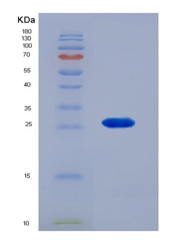 SDS-PAGE analysis of Human FOLR1 (Folate Receptor Alpha) - Recombinant Protein, CAT# BLT-01103P, showing >85% purity under 15% SDS-PAGE (Reduced)Human FOLR1 (Folate Receptor Alpha) - Recombinant Protein