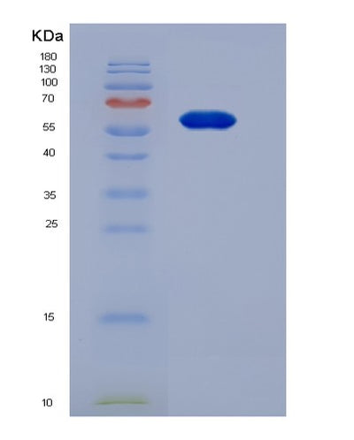 SDS-PAGE analysis of Human VAV1 (Proto-Oncogene Vav) - Recombinant Protein, CAT# BLT-03276P, showing >95% purity under 15% SDS-PAGE (Reduced)Human VAV1 (Proto-Oncogene Vav) - Recombinant Protein