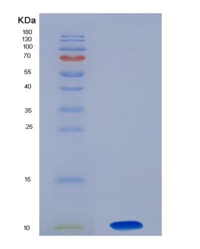 SDS-PAGE analysis of Human CSF2RA (Granulocyte-Macrophage Colony-Stimulating Factor Receptor Subunit Alpha) - Recombinant Protein, CAT# BLT-00717P, showing >90% purity under 15% SDS-PAGE (Reduced)Human CSF2RA (Granulocyte-Macrophage Colony-Stimulating Factor Receptor Subunit Alpha) - Recombinant Protein