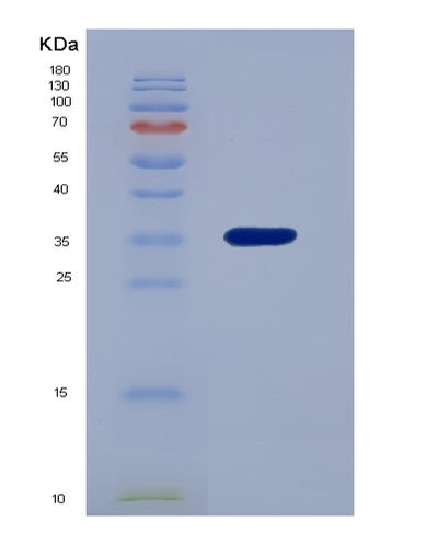 SDS-PAGE analysis of Human HTN3 (Histatin-3) - Recombinant Protein, CAT# BLT-04513P, showing >90% purity under 15% SDS-PAGE (Reduced)Human HTN3 (Histatin-3) - Recombinant Protein
