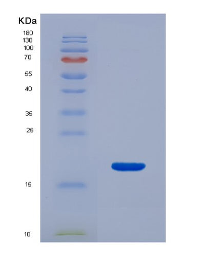 SDS-PAGE analysis of Human CD46 (Membrane Cofactor Protein) - Recombinant Protein, CAT# BLT-00501P, showing >85% purity under 15% SDS-PAGE (Reduced)Human CD46 (Membrane Cofactor Protein) - Recombinant Protein