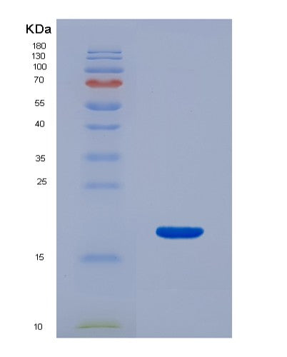 SDS-PAGE analysis of Human CD46 (Membrane Cofactor Protein) - Recombinant Protein, CATHuman CD46 (Membrane Cofactor Protein) - Recombinant Protein