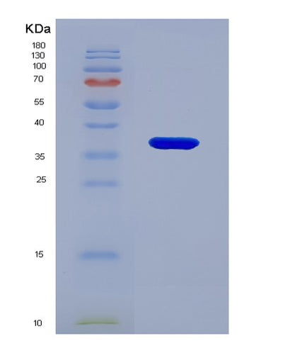 SDS-PAGE analysis of Human SRD5A2 (3-Oxo-5-Alpha-Steroid 4-Dehydrogenase 2) - Recombinant Protein, CAT# BLT-07557P, showing >90% purity under 15% SDS-PAGE (Reduced)Human SRD5A2 (3-Oxo-5-Alpha-Steroid 4-Dehydrogenase 2) - Recombinant Protein