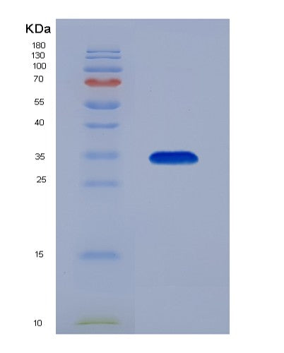 SDS-PAGE analysis of Human CBR1 (Carbonyl Reductase [Nadph] 1) - Recombinant Protein, CATHuman CBR1 (Carbonyl Reductase [Nadph] 1) - Recombinant Protein