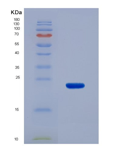 SDS-PAGE analysis of Human ACADS (Short-Chain Specific Acyl-Coa Dehydrogenase, Mitochondrial) - Recombinant Protein, CATHuman ACADS (Short-Chain Specific Acyl-Coa Dehydrogenase, Mitochondrial) - Recombinant Protein