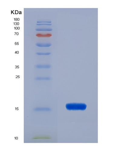 SDS-PAGE analysis of Human FABP1 (Fatty Acid-Binding Protein, Liver) - Recombinant Protein, CAT# BLT-07558P, showing >90% purity under 15% SDS-PAGE (Reduced)Human FABP1 (Fatty Acid-Binding Protein, Liver) - Recombinant Protein