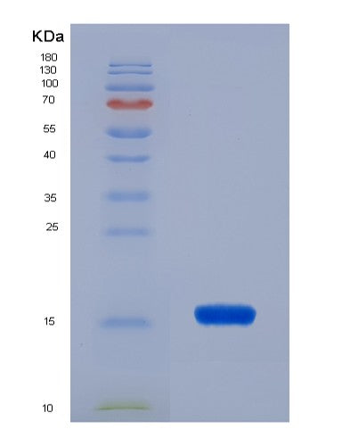 SDS-PAGE analysis of Human FABP1 (Fatty Acid-Binding Protein, Liver) - Recombinant Protein, CATHuman FABP1 (Fatty Acid-Binding Protein, Liver) - Recombinant Protein