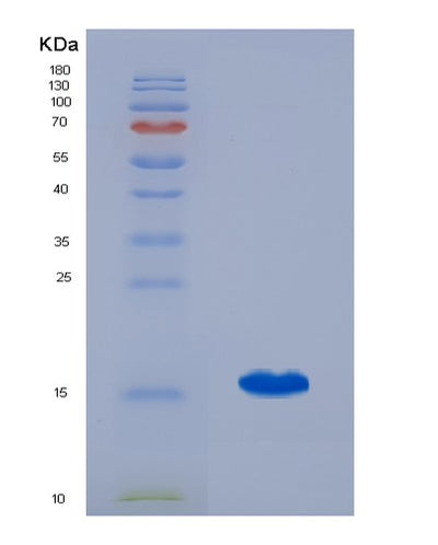 SDS-PAGE analysis of Human FABP5 (Fatty Acid-Binding Protein 5) - Recombinant Protein, CAT# BLT-07559P, showing >90% purity under 15% SDS-PAGE (Reduced)Human FABP5 (Fatty Acid-Binding Protein 5) - Recombinant Protein