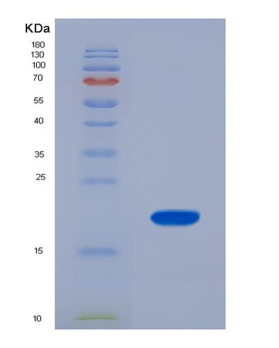SDS-PAGE analysis of Human FABP6 (Gastrotropin) - Recombinant Protein, CAT# BLT-07560P, showing >90% purity under 15% SDS-PAGE (Reduced)Human FABP6 (Gastrotropin) - Recombinant Protein