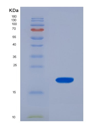 SDS-PAGE analysis of Human FABP6 (Gastrotropin) - Recombinant Protein, CATHuman FABP6 (Gastrotropin) - Recombinant Protein