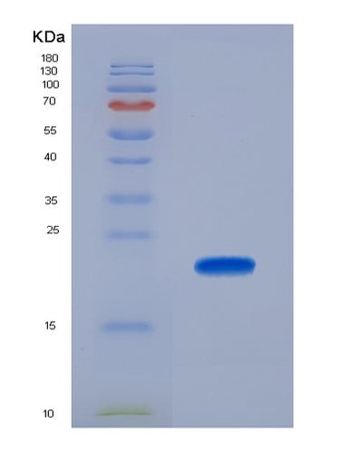 SDS-PAGE analysis of Human CTLA4 (Cytotoxic T-Lymphocyte Protein 4) - Recombinant Protein, CAT# BLT-00746P, showing >90% purity under 15% SDS-PAGE (Reduced)Human CTLA4 (Cytotoxic T-Lymphocyte Protein 4) - Recombinant Protein