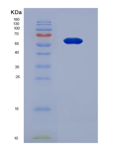 SDS-PAGE analysis of Mouse Prg4 (Proteoglycan 4) - Recombinant Protein, CAT# BLT-07562P, showing >90% purity under 15% SDS-PAGE (Reduced)Mouse Prg4 (Proteoglycan 4) - Recombinant Protein