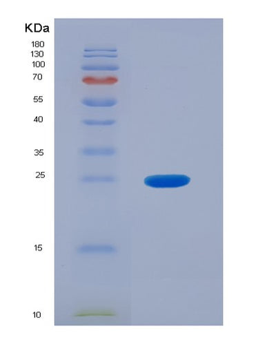 SDS-PAGE analysis of Human MGMT (Methylated-Dna--Protein-Cysteine Methyltransferase) - Recombinant Protein, CAT# BLT-03876P, showing >95% purity under 15% SDS-PAGE (Reduced)Human MGMT (Methylated-Dna--Protein-Cysteine Methyltransferase) - Recombinant Protein