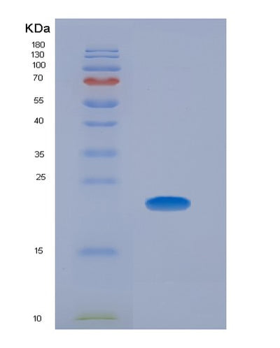 SDS-PAGE analysis of Human CPE (Carboxypeptidase E) - Recombinant Protein, CAT# BLT-00676P, showing >85% purity under 15% SDS-PAGE (Reduced)Human CPE (Carboxypeptidase E) - Recombinant Protein